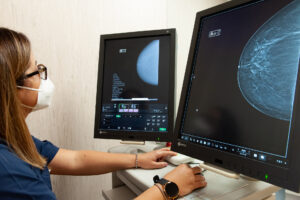 dottoressa che analizza schermi con radiologia senologica e screening mammografico